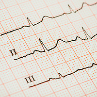 Buy canvas prints of Sinus Heart Rhythm On Electrocardiogram Paper by Radu Bercan