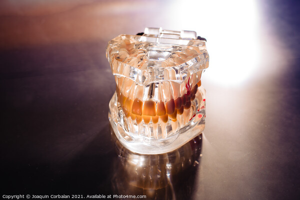 Plastic mold of a jaw with teeth, on a dentist's stainless table Picture Board by Joaquin Corbalan