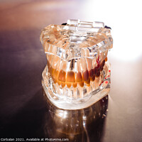 Buy canvas prints of Plastic mold of a jaw with teeth, on a dentist's stainless table by Joaquin Corbalan