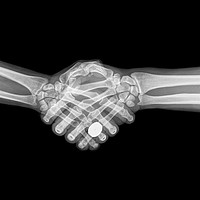Buy canvas prints of X-ray of two people shaking hands  by PhotoStock Israel