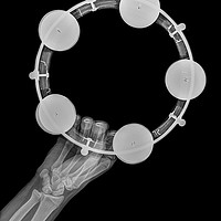 Buy canvas prints of Tambourine under x-ray  by PhotoStock Israel