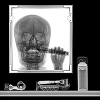 Buy canvas prints of x-ray of a person brushing his teeth by PhotoStock Israel